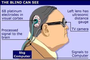 הפרוטזה האלקטרונית של עיניו ומוחו של ג'רי (דובל, 2000)